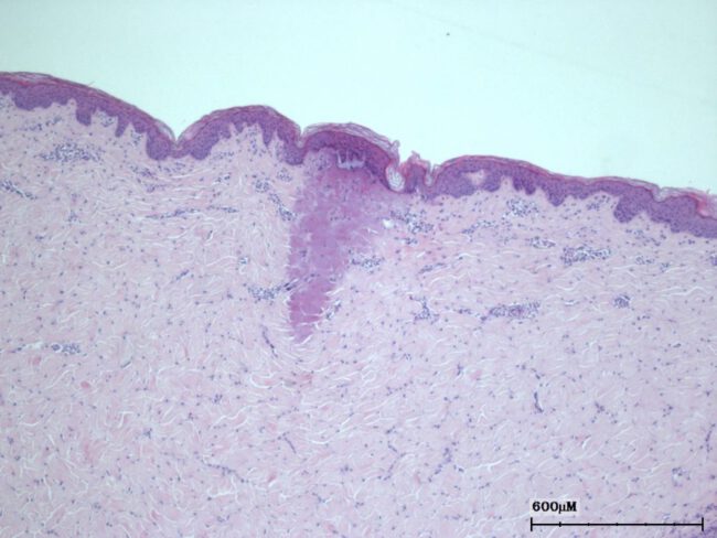 Histology Data on Porcine Skin Histology Data on Porcine Skin