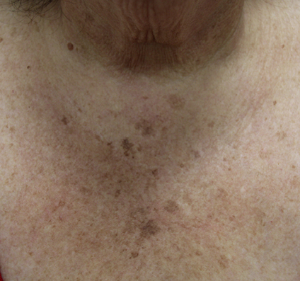 Before Bio-Boost