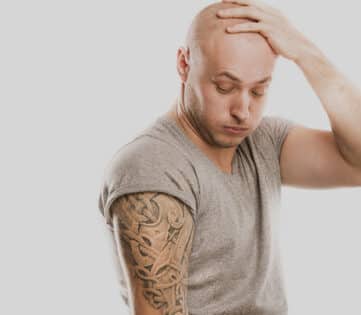 How to Remove a Tattoo: Everything You Need to Know How to Remove a Tattoo: Everything You Need to Know
